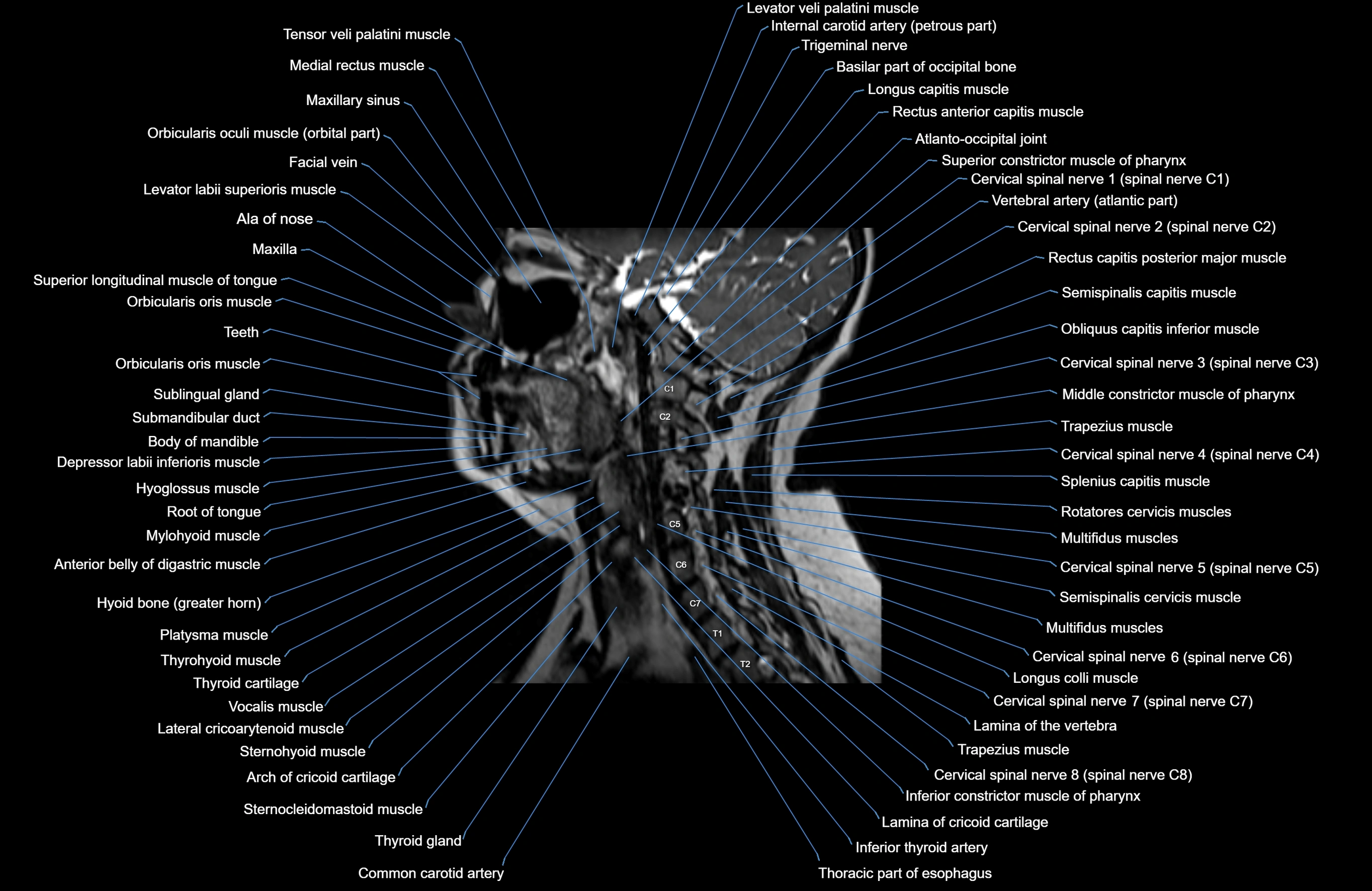 Neck MRI sagittal cross sectional anatomy 3D 1mm 3T radiology  image-img-00001-00012.webp